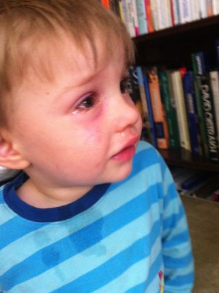 My poor little man! :(